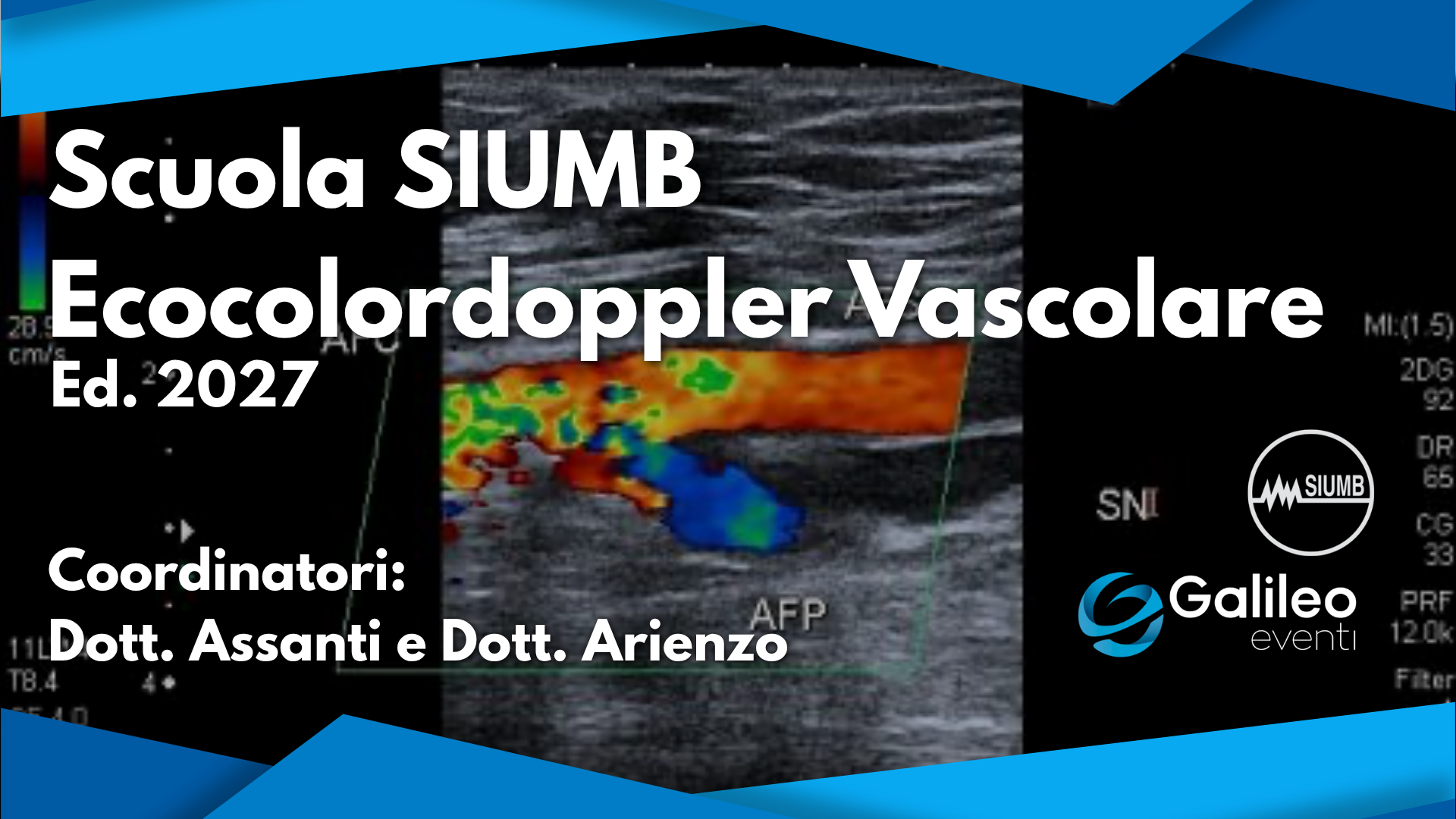 Scuola SIUMB di Ecocolordoppler Vascolare